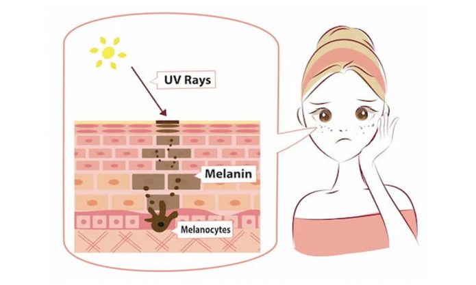 Sắc tố melanin là gì